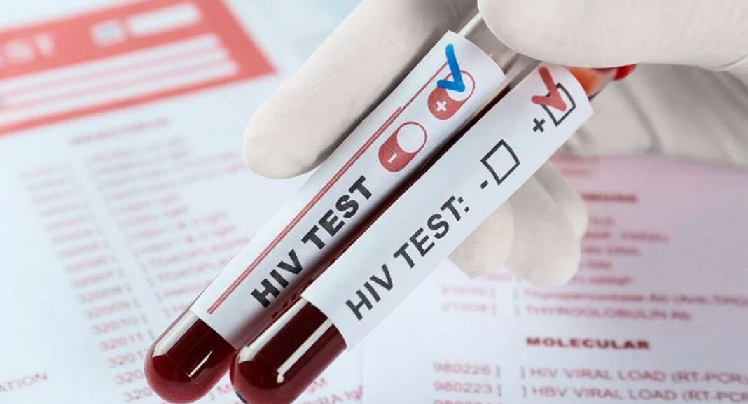 México identificó más de 15 mil casos nuevos de VIH durante 2025